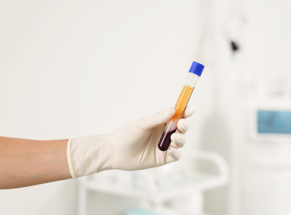 What Is An O-Shot Treatment?