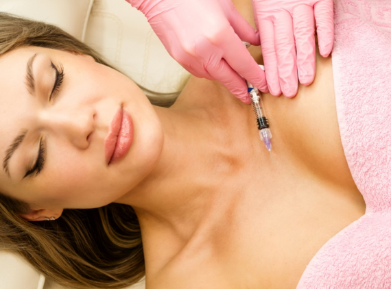 What Is the Vampire Breast Lift?